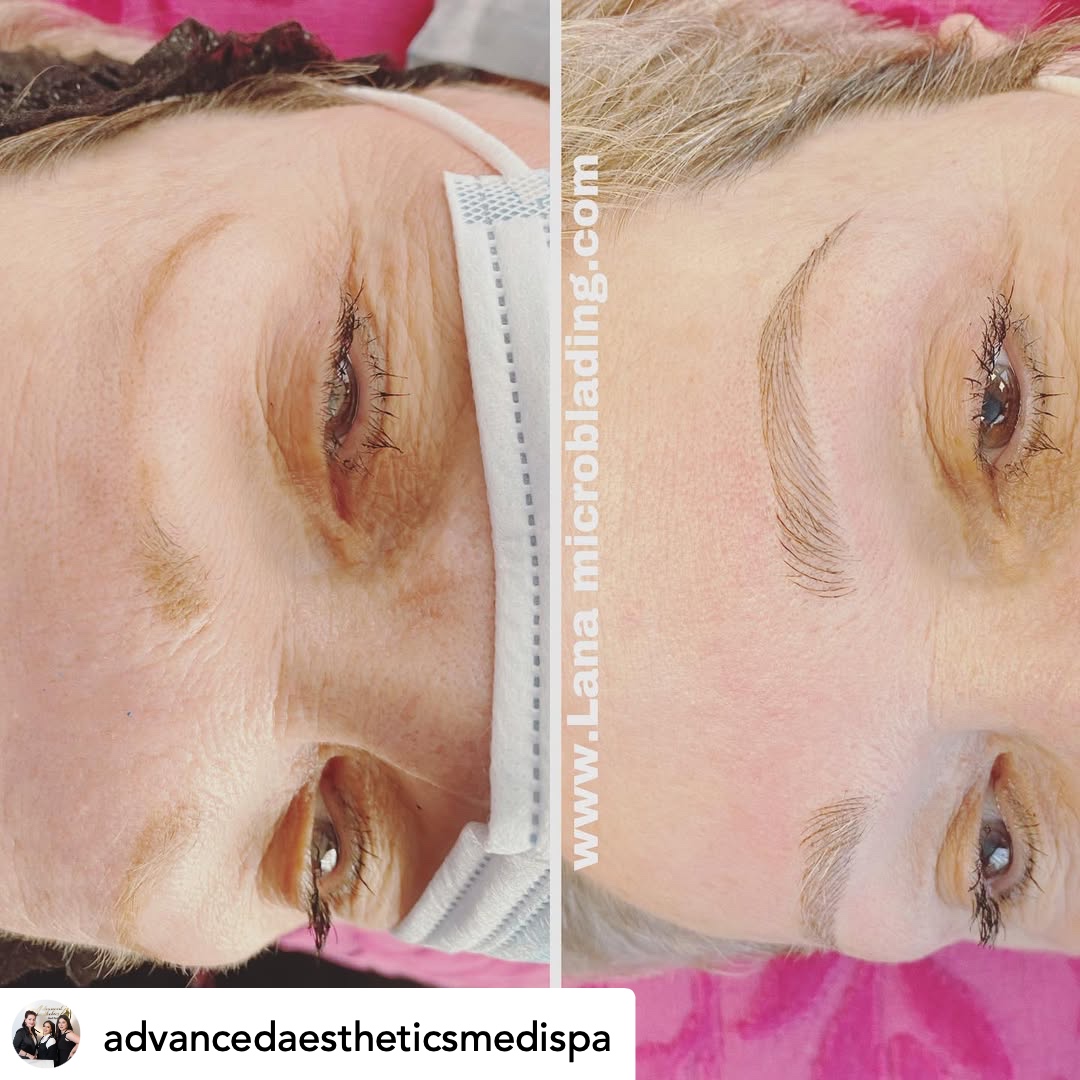 Before and after microblading — natural hair-stroke brows with face mask