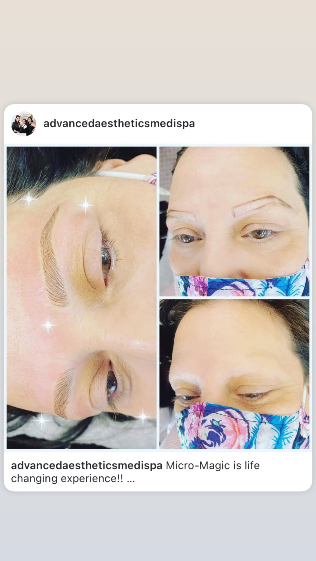 Before and after eyebrow microblading