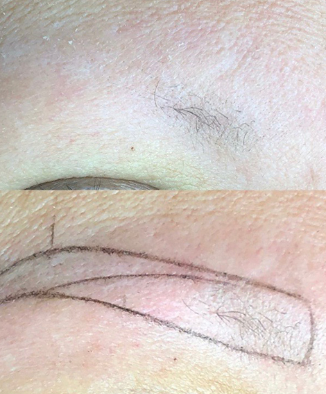Brow shape mapped on a client before microblading